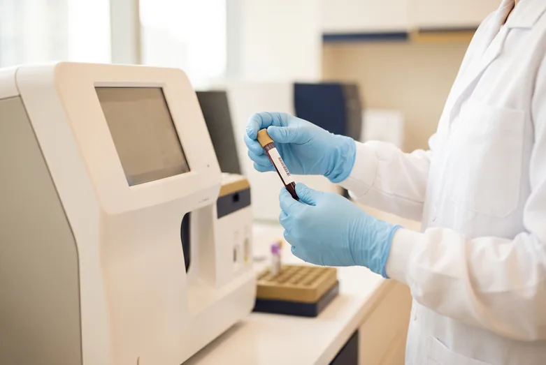 Laboratory technician handling a blood sample tube for a homocysteine test at a Singapore clinic