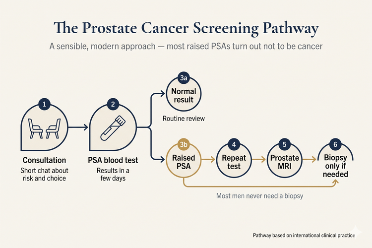 Flow diagram of the prostate cancer screening pathway in Singapore — consultation, PSA blood test, and de-escalating steps (repeat test, MRI, biopsy only if needed) depending on the result
